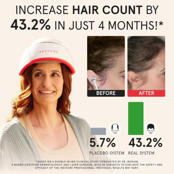 iRestore Essential Laser Hair Loss Treatment - Image 4